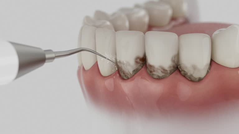 Reliable Teeth Cleaning And Checkup contractor in Jasper County County, GA by Dentist Open Now